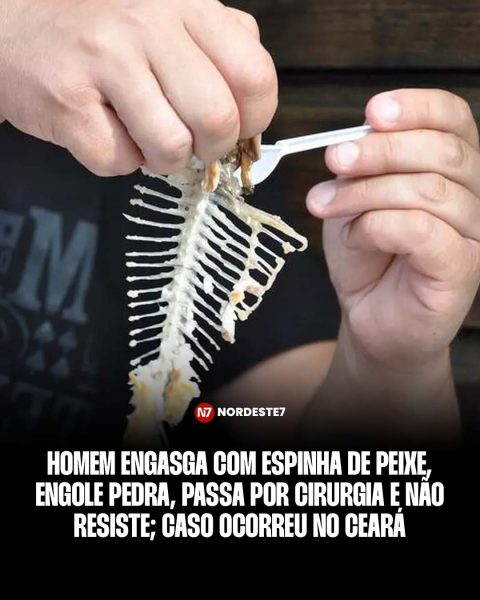 Homem engasga com espinha de peixe, engole pedra, passa por cirurgia e não resiste; caso ocorreu no Ceará — Região.