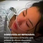 Jovem sobrevive a 22 facadas após próteses de silicone absorverem impactos, confirmam médicos — Mundo. Equipe médi