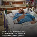 Homem acorda do coma e descobre que perdeu as duas pernas devido a uma queimadura — Mundo. Ferimento no polegar evolui