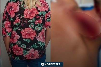 Mulher corta pescoço de homem após ele se recusar a ter relação — Brasil. Discussão começou dentro de supermerca