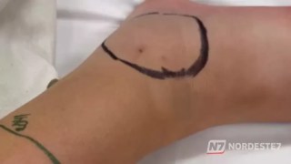 Mulher sentada em uma trilha de terra ao lado de sua bicicleta, segurando a perna após ser picada por uma cobra.